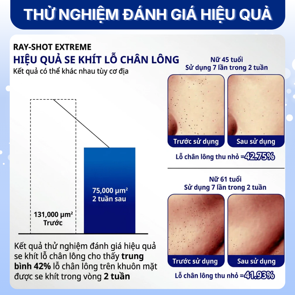 Tinh Chất Vi Kim hỗ trợ Mờ Nám Sáng Da Giảm Nếp Nhăn It's be RAY-SHOT Brightening Extreme (Rayshot 300) - Hình ảnh 6