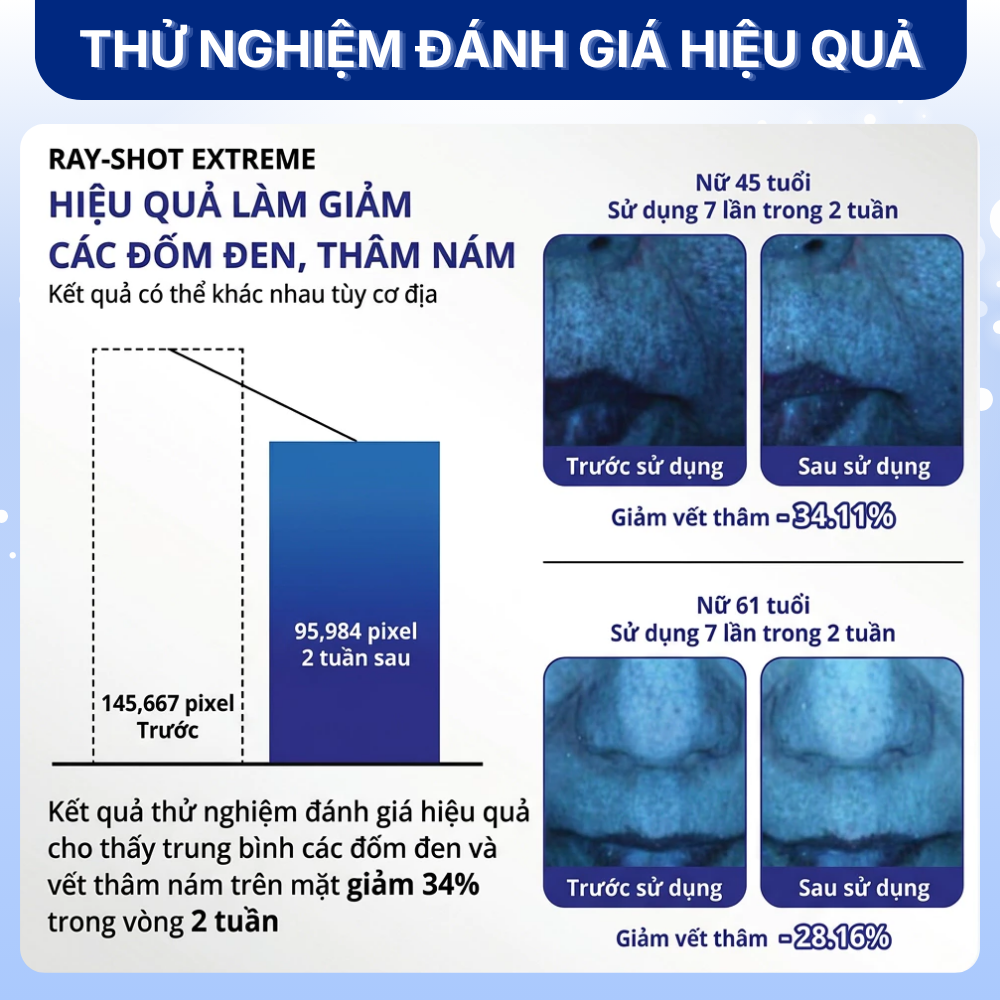 Tinh Chất Vi Kim hỗ trợ Mờ Nám Sáng Da Giảm Nếp Nhăn It's be RAY-SHOT Brightening Extreme (Rayshot 300) - Hình ảnh 5